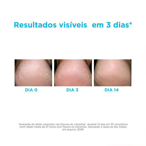 Gel Óleo Hidratante Para Pés Ureadin Podos 75Ml