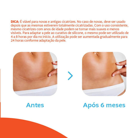 Curativo Cremer Advance Para Cicatrização 4 Unidades