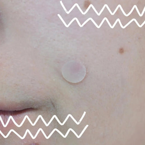 Curativo Cremer Advanced Acne e Espinhas 24 Unidades