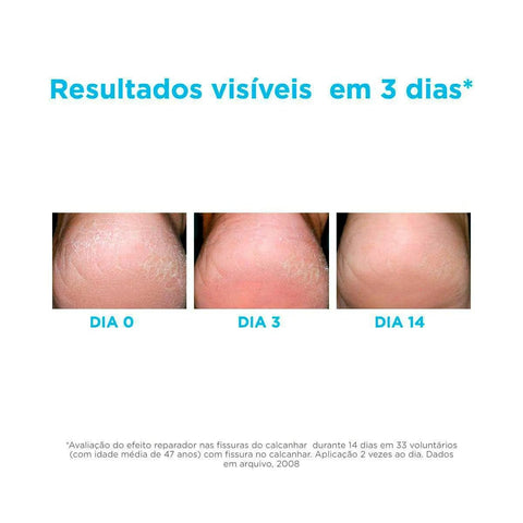 Hidratante Para Os Pés ISDIN Foot Care Ureadin Podos Gel 80,25g