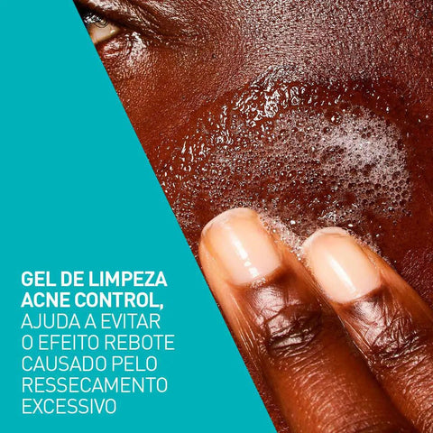 Gel de Limpeza Facial CeraVe Acne Control Pele Oleosa e Acnéica - 60 g
