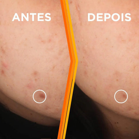 Serum Garnier Uniform & Matte Vitamina Com 15 Ml