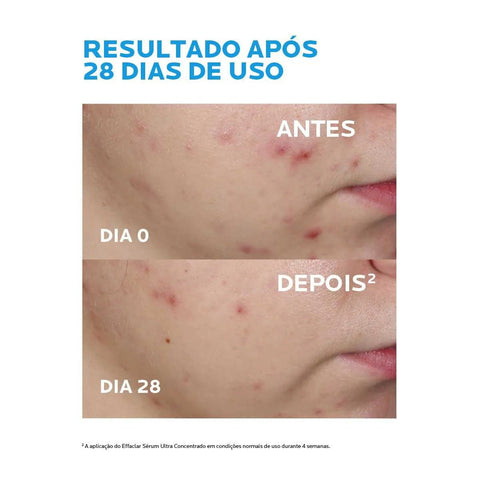 Sérum La Roche-Posay Effaclar Ultra Concentrado Antiacne  15 mL