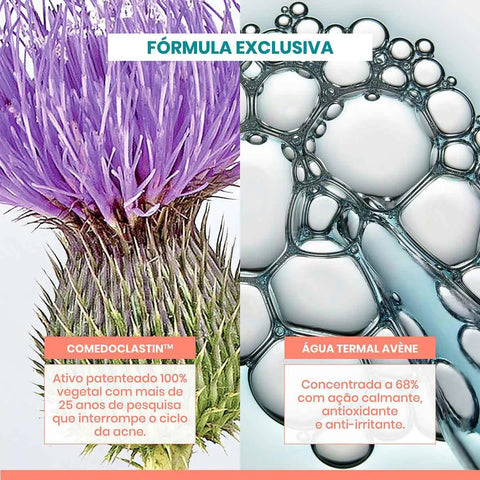 Sérum Corretor Facial Antiacne Avène Cleanance Comedomed Com 30ml