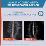 Sérum Ducray Neoptide Expert 2x50ml