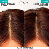 Loreal Shampoo Elseve Hialuronico Pure 200ml