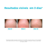Hidratante Para Os Pés ISDIN Foot Care Ureadin Podos Gel 80,25g