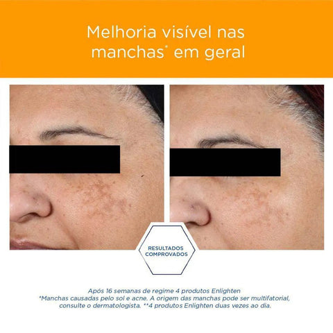 Neostrata Pigment Controler 50 Ml