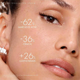 Normaderm Phytosolution Tratamento 50Ml Loreal .