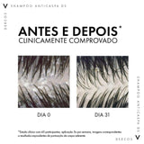 Shampoo Vichy Dercos  Linha Anticaspa DS - Cabelos Normais a Oleosos - 125 g