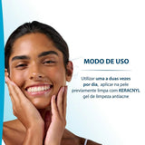 Ducray Keracnyl Mat Cuidado Matificante Para Pele Mista À Oleosa 30mL(3282770206821)