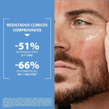 Gel de Limpeza Anti-Descamação Kelual Ds 200g